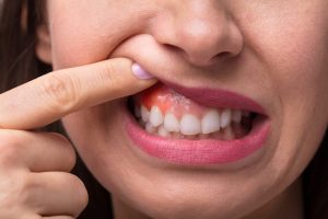 gum health importance
