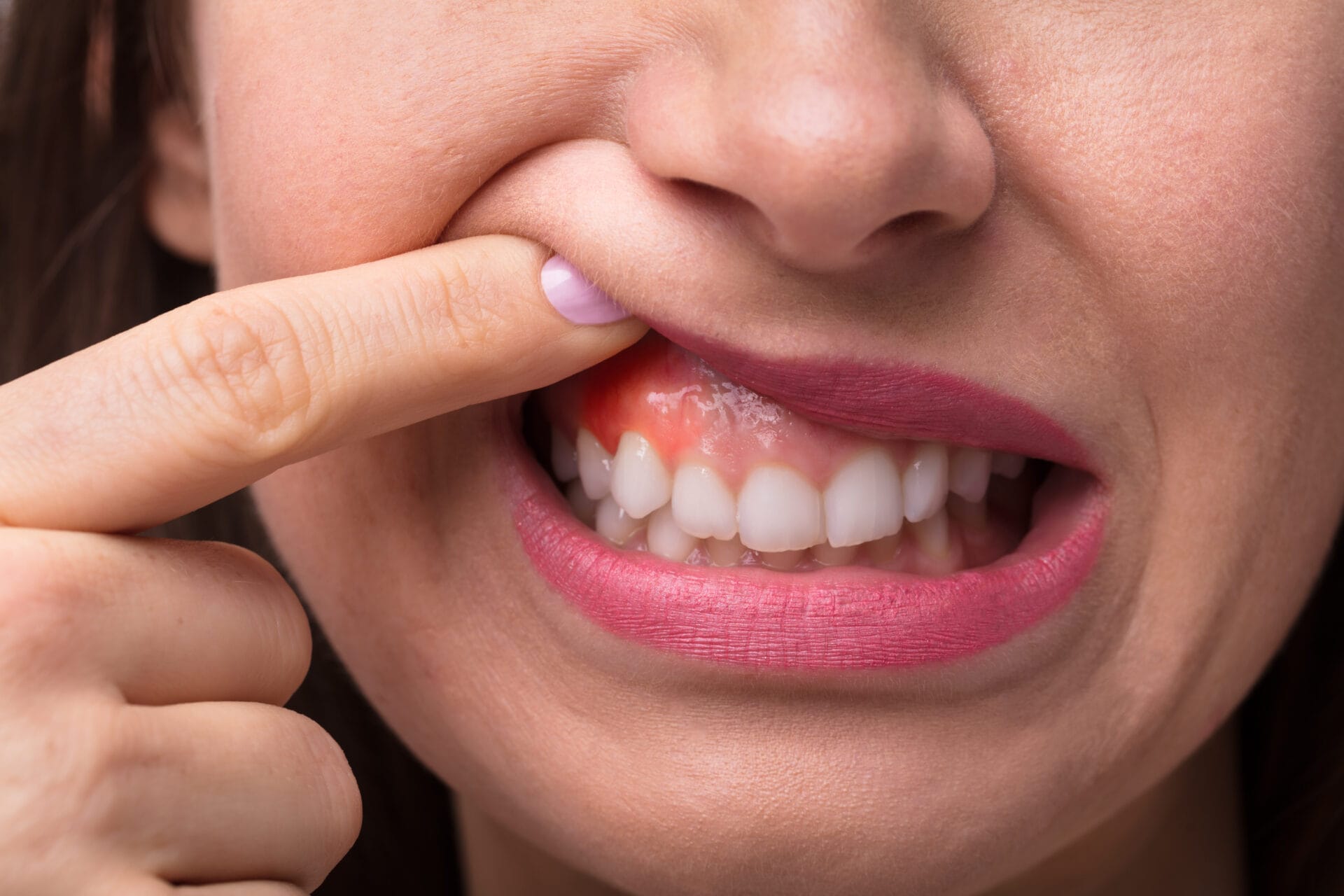 gum health importance