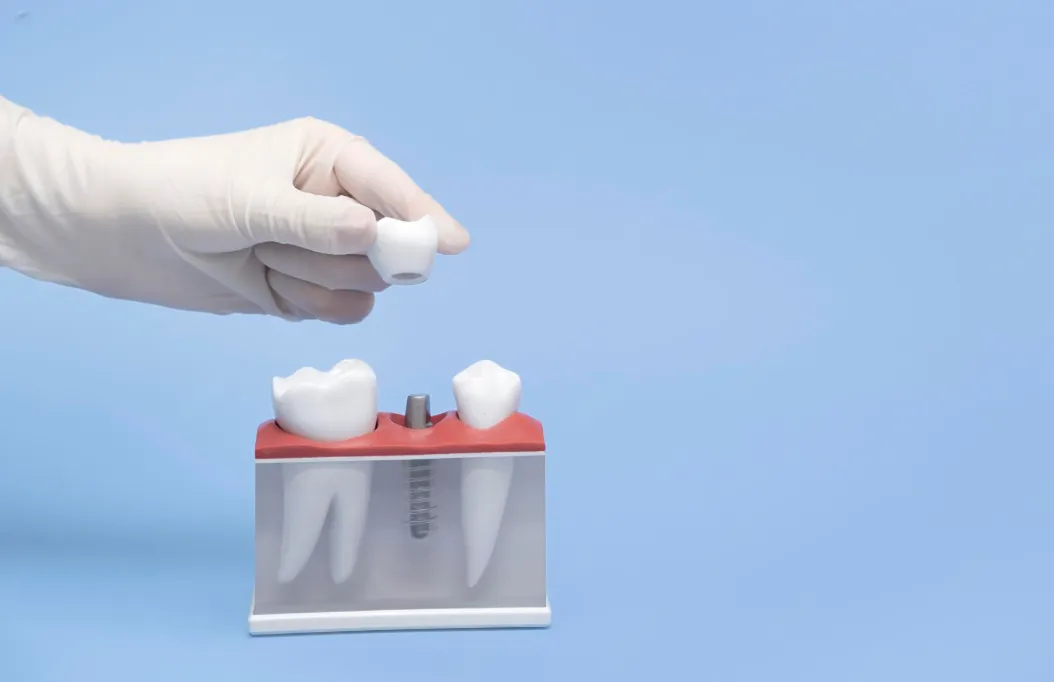 choosing right dental crown material