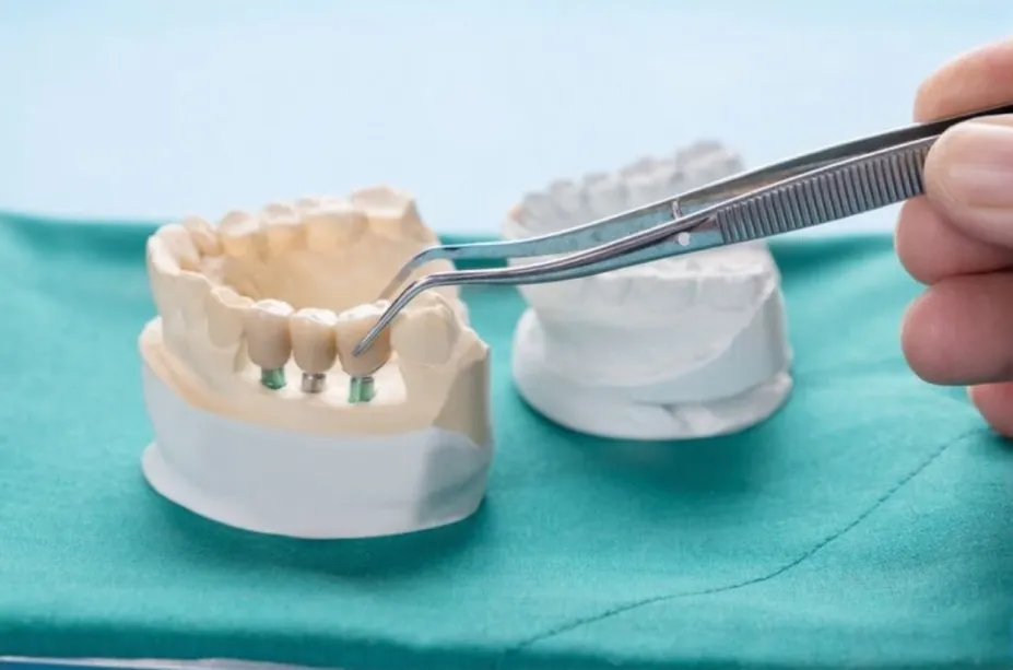 dental bridges improve oral function