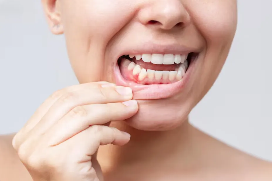 periodontal treatment